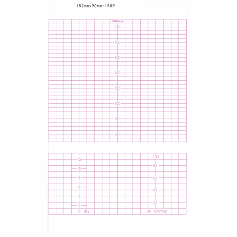 Replacement-Recording Paper 152mm*90mm-150P used for Fetal Monitor ANALOGIC 3000, GE170 SERIES SKU: TNC-AL-PA010