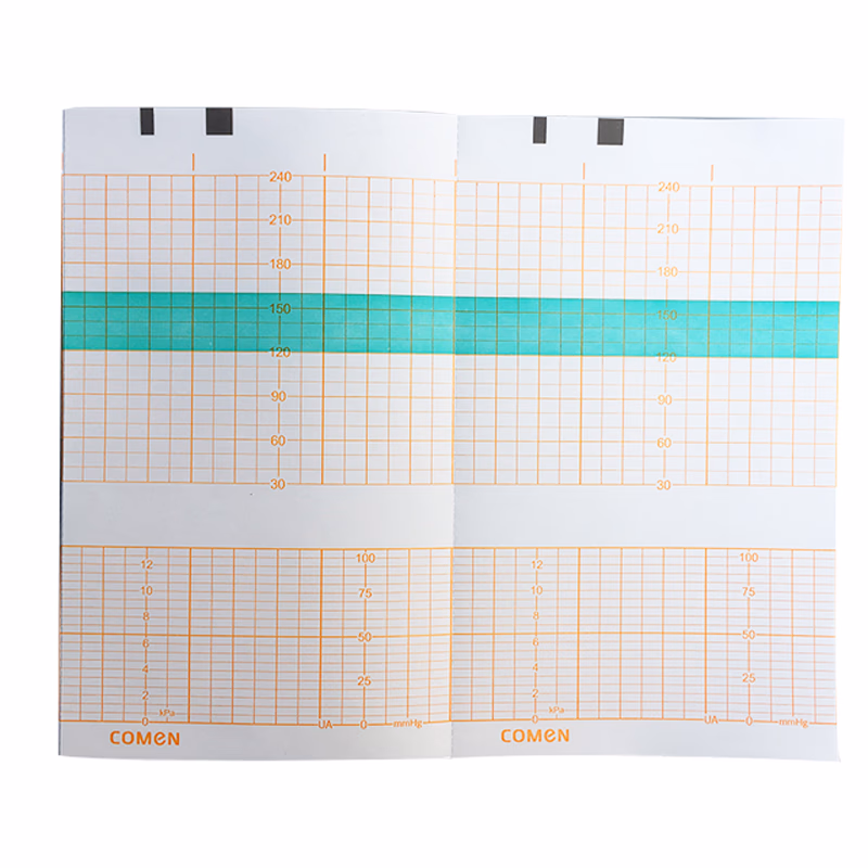 Replacement-Recording Paper 150mm*90mm-150Sheet used for Fetal Monitor Comen 5000D / 5000F / C20 SKU: TNC-CM-PA011